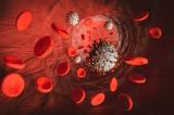 Аутоиммунитет приводит к тяжелым осложнениям у пациентов с коронавирусом