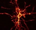 Допамин закрепляет воспоминания, связанные с наркотиками