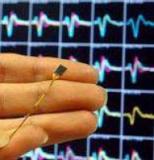 Имплантат зафиксировал внимание парализованного человека