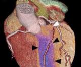 Японцы хотят повысить качество диагностики болезней сердца