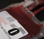 Кому беспокоиться меньше: связь группы крови с вероятностью инфаркта