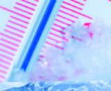 Лечение холодом: криотерапия, аэрокриотерапия