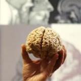 Новый белок защитит мозг от инсульта