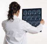 Киста головного мозга 