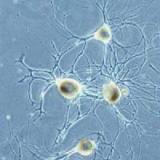 Исследователи нашли ключевой механизм развития нервных клеток