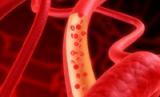 Найден виновник инсультов и инфарктов