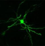 Новости о хорее Гентингтона