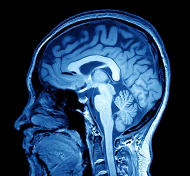 Корни расизма обнаружены на сканах мозга